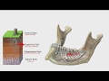 5 REASONS WHY LONGER IMPLANTS ARE BETTER THAN SHORTER IMPLANTS?