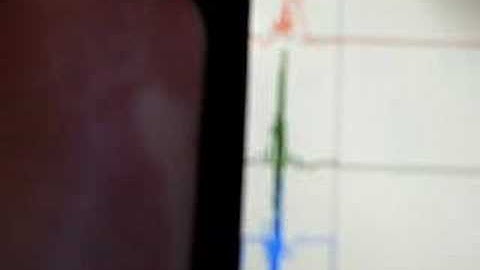 Accelerometer Log for iPhone & iPod Touch