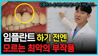 임플란트 단점과 부작용, 수술하기 전에 꼭 알고 받으세요ㅣ부산임플란트, 사상역 치과