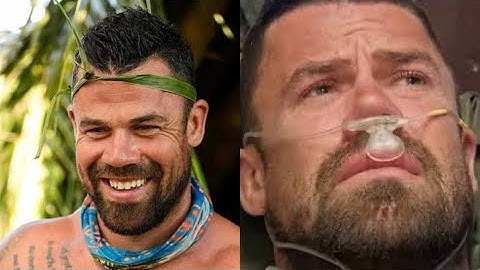 Survivor 49’s Jake Latimer Details His Recovery After a Snake Bite Scare