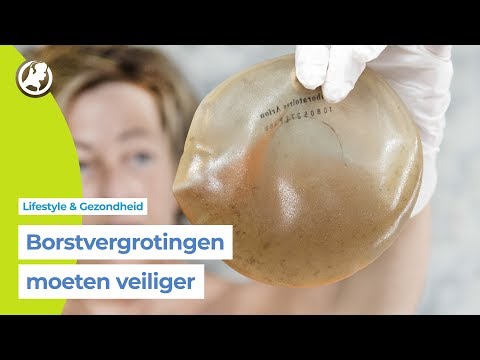 Video: 3 manieren om borstimplantaten te genezen