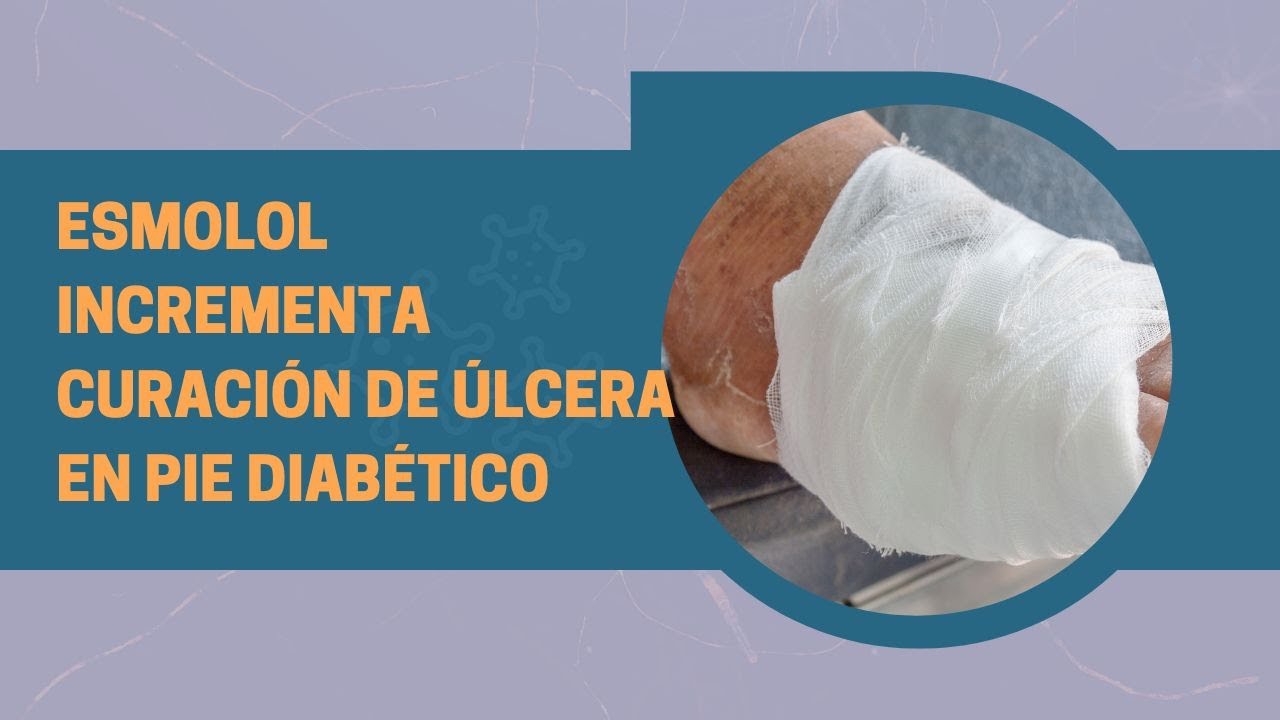 Esmolol incrementa curación de úlcera en pie diabético YouTube