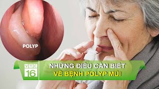 Những điều cần biết về bệnh Polyp mũi | VTC16