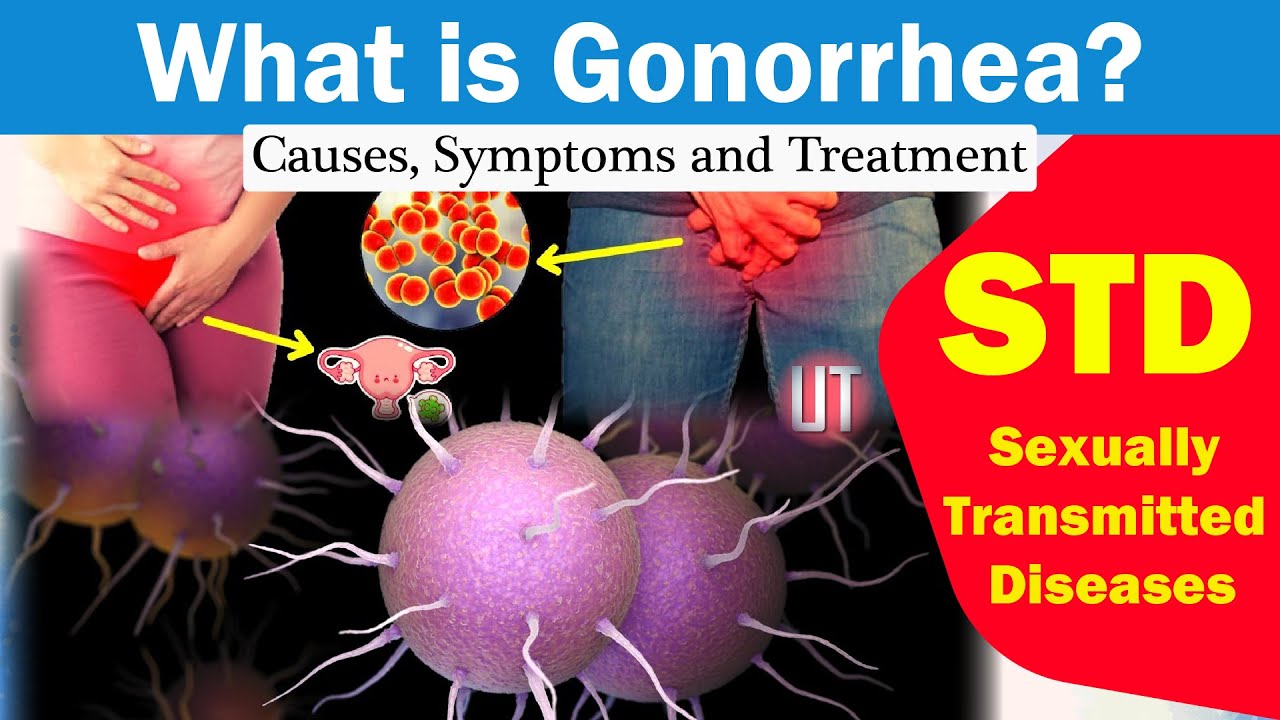 What Is Gonorrhea Youtube