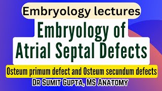 Atrial Septal Defects | Embryological basis