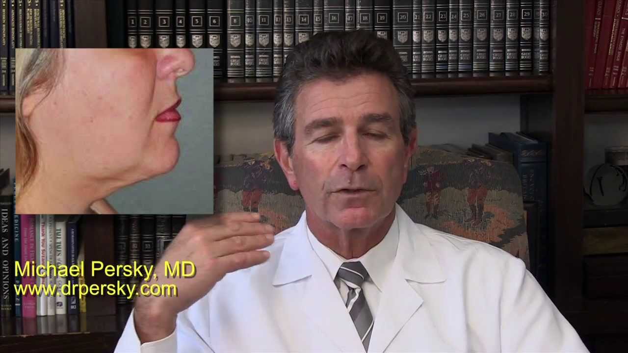 Neck Liposuction Treatment Encino, Los Angeles, Ca