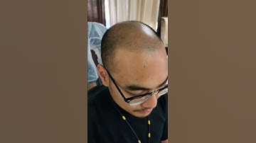 2nd Session @microscalp_eric #scalpmicropigmentation #microscalp #smp