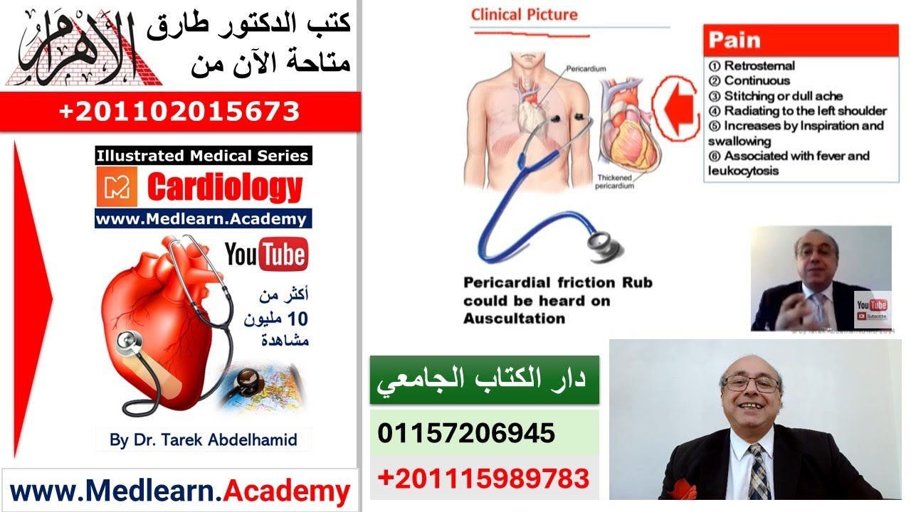 Acute Pericarditis #cme #internal_medicine #medical #us… — Transcript