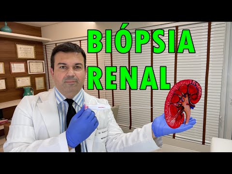 Vídeo: Biópsia Renal: Objetivo, Procedimento E Riscos