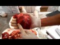 Cardiovascular system  the heart  topography