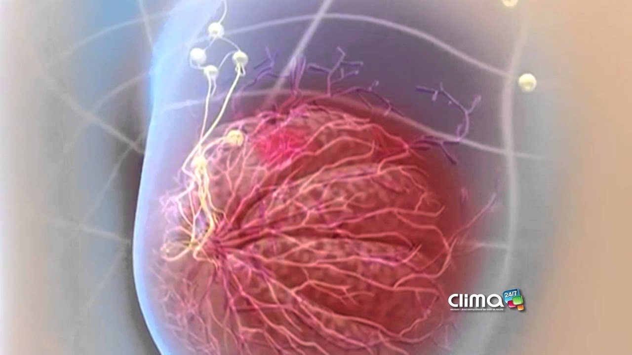 Efectos del aire contaminado en el cuerpo
