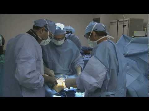 Live Unedited Total Ankle Replacement - Part 1 | Thomas San Giovanni, M.D. | Doctors Hospital