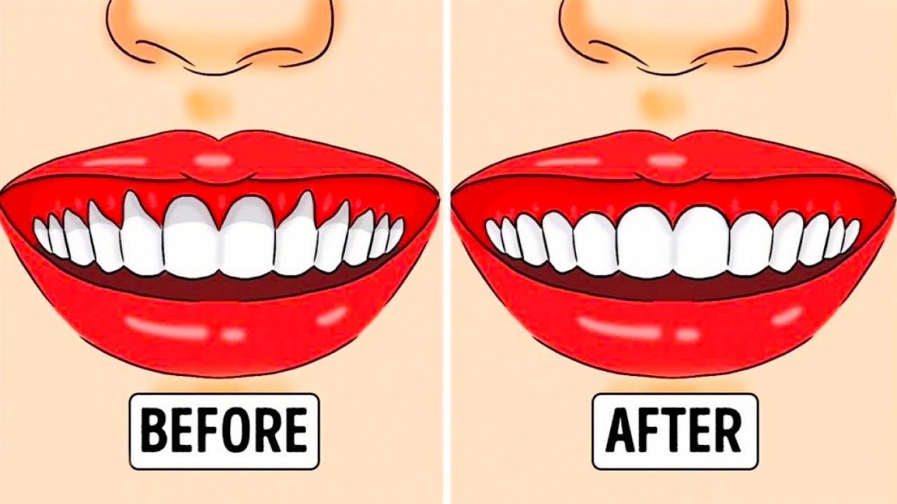 20 TIPS TO GET THE PERFECT HOLLYWOOD SMILE