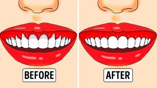 20 TIPS TO GET THE PERFECT HOLLYWOOD SMILE