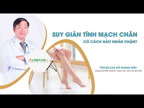 Video Suy giãn tĩnh mạch chân có cách nào ngăn chặn? | Bệnh... - youtube
