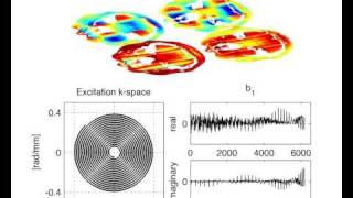 MRI: Single channel selective inversion