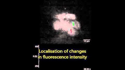 Widefield Two-Photon Excitation without Scanning: Live Cell Microscopy with High Time Resolution