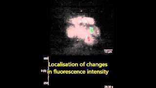 Widefield Two-Photon Excitation without Scanning: Live Cell Microscopy with High Time Resolution