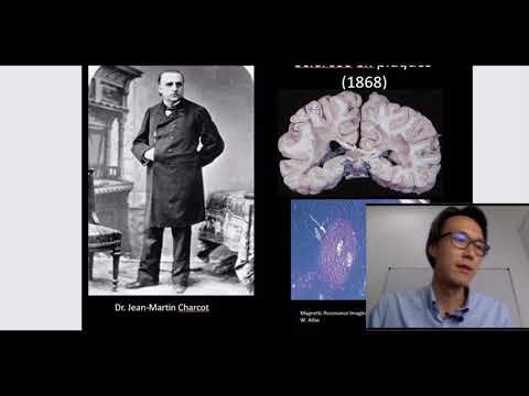 Vídeo: Esclerose Múltipla Imagens De Ressonância Magnética Do Cérebro