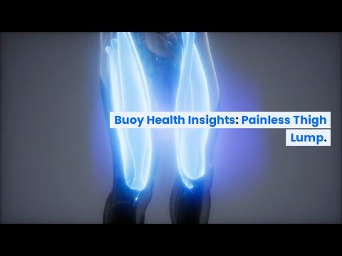 Painless Thigh Lump: Common Causes and When to Seek Medical Care  | BuoyHealth.com