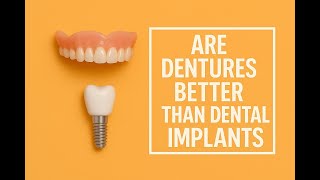 Dentures vs Implants: Which Is Better for You? | Talking Dentures Explains