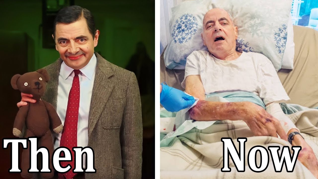 Mr. Bean Tv Series 1990 Cast THEN AND NOW 2023 All Actors Have Aged