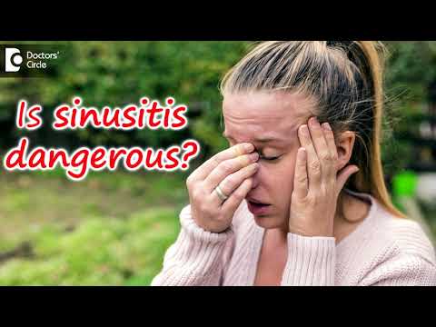 Video: Je sfénoidná sinusitída nebezpečná?