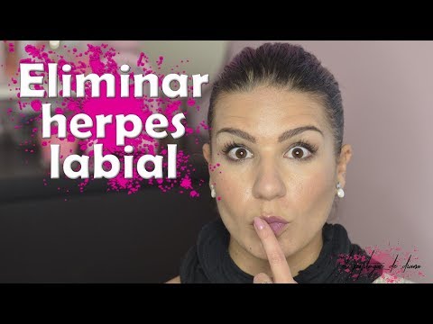 Herpes labial - MILAGRO natural para eliminarlo de inmediato