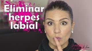 Herpes labial  MILAGRO natural para eliminarlo de inmediato