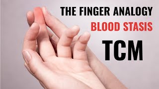 Blood Stasis In TCM - The Finger Analogy