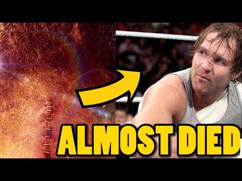 Top 10 WWE Wrestlers Who Almost Died As A Result Of A Wrestling Injury