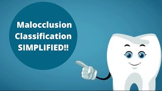 Incisors, Canines and Molars Malocclusion Classification Malocclusion Classification