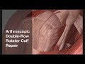 Double-Row Rotator Cuff Repair