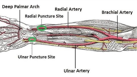 Anatomy of the radial artery ; Overview, Origin, Course, Branches, Functions, Clinical Significance