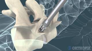 Impact Multimedia - 3D Animation - TDX Blackstone