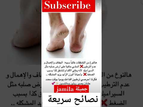 أسباب تشقق القدمين وعلاجه معلومه سريعه جمال طبيعي عنايه