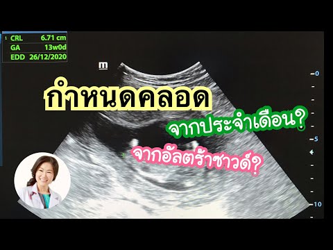 วีดีโอ: วิธีการกำหนดระยะเวลาของการตั้งครรภ์ด้วยอัลตราซาวนด์
