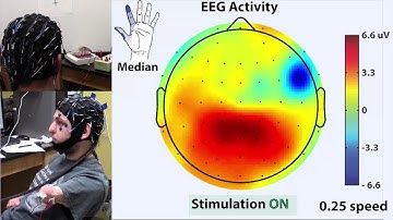 Dynamic EEG activity during nerve stimulation (Movie S1, Osborn et al, Science Robotics 2018)