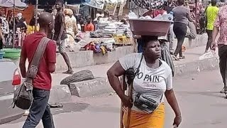 Amputee Lady And The Government Should She Get The 25m