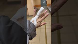 Моя история о заказе, воспалённом пальце и неожиданной операции!