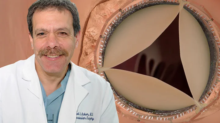 The Future of Heart Valve Surgery: Insights from D...