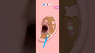 ear operation 3d animation short