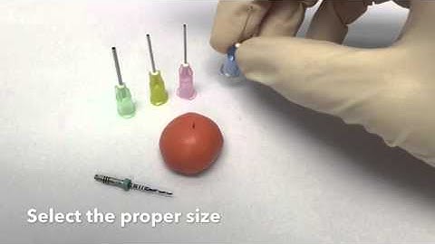 The BOA Technique for removing root canal obstructions