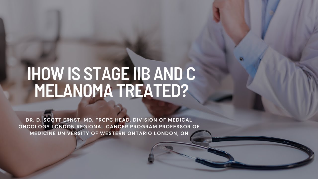 How is stage IIB and C melanoma treated? - YouTube