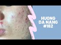 #162 | Huong Da Nang