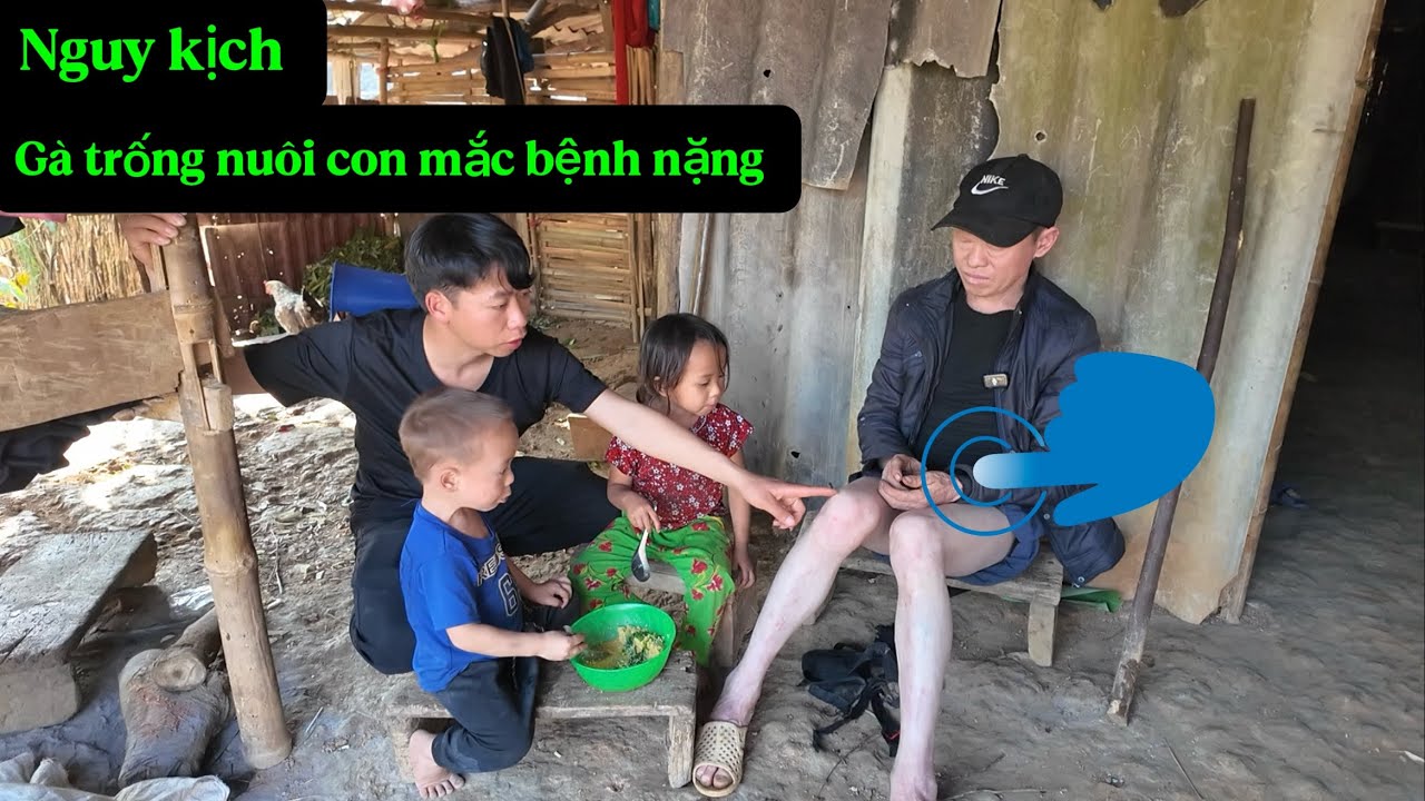Buồn thay Anh Dính bạch tạng người bố duy nhất,bây giờ mắc bệnh nặng,các con phải đi xin ăn.