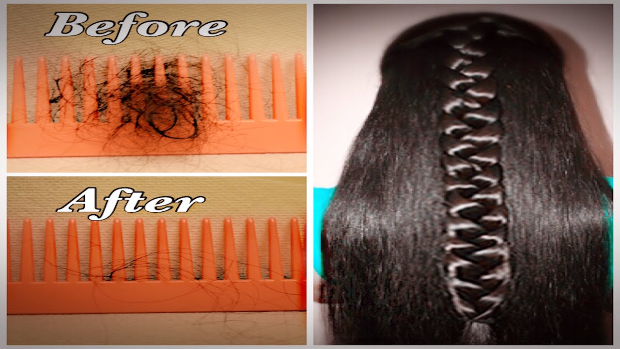 How to GROW HAIR in a week(INDIAN). Miracle Mask for Hair Fall Control