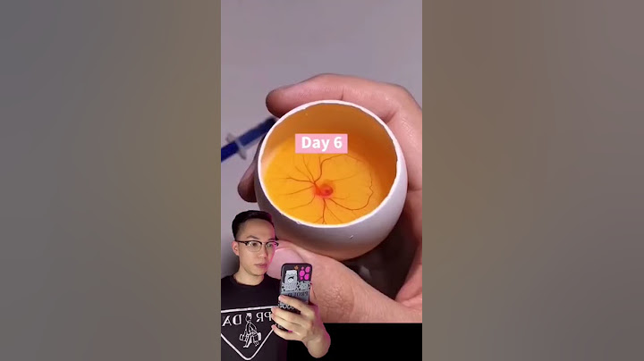 Ấp trứng nhân tạo theo TikTok và cái kết | Hưng Rì Viu #shorts