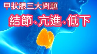 甲狀腺三大問題 : 甲狀腺結節、亢進、低下 (上)