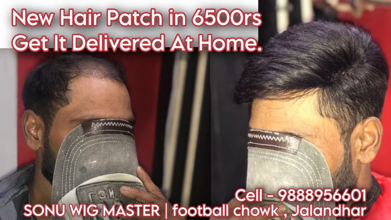 20250 NEW HAIR PATCH AT WHOLESALE PRICE CONTACT US 9888956601